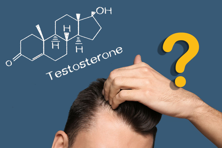 Does Testosterone Cause Hair Loss?
