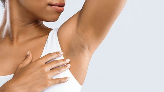 Hyperhidrosis